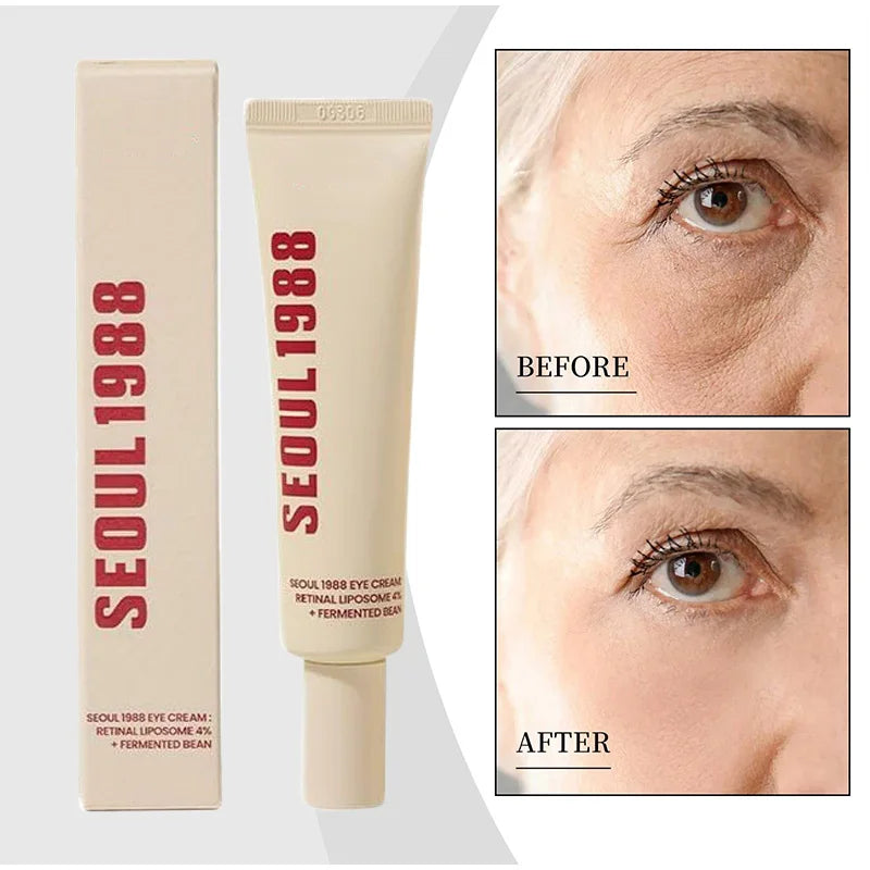 Seoul 1988 Retinol Eye Cream 4% – Advanced Anti-Aging Eye Treatment