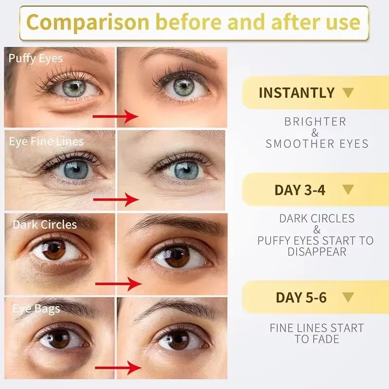 Instant Eye Bag Removal Cream Retinol Anti-Wrinkle Firming Skin Fade Fine Lines Anti Dark Circle Puffiness Brighten Eye skinCare