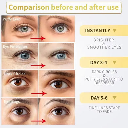 Instant Eye Bag Removal Cream Retinol Anti-Wrinkle Firming Skin Fade Fine Lines Anti Dark Circle Puffiness Brighten Eye skinCare