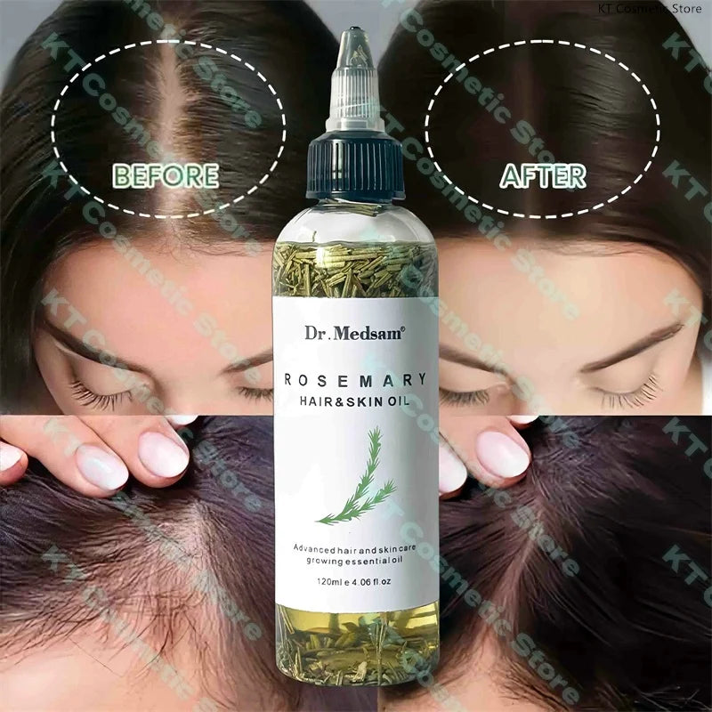 100ML Fast Hair Growth Oil Africa Crazy Traction Alopecia Serum Anti Hair Break Thicken Hair Loss Treatment Spray For Man Women