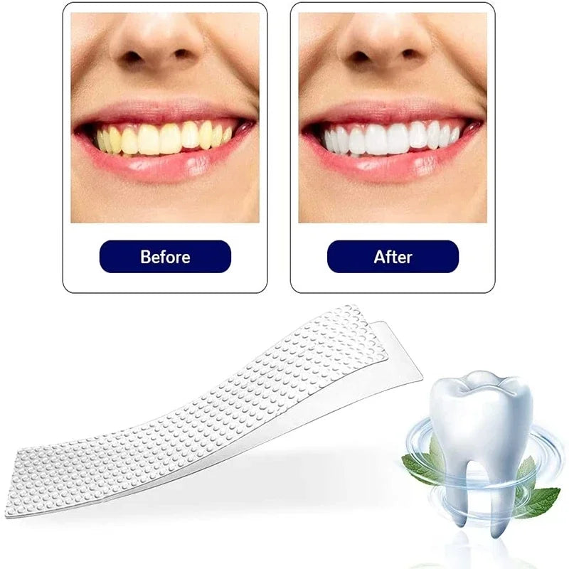 5D Whitening Teeth Stickers 7/14 Pairs Gel Whitening Strips