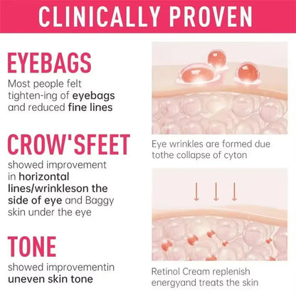 Instant Eye Bag Removal Cream Retinol Anti-Wrinkle Firming Skin Fade Fine Lines Anti Dark Circle Puffiness Brighten Eye skinCare