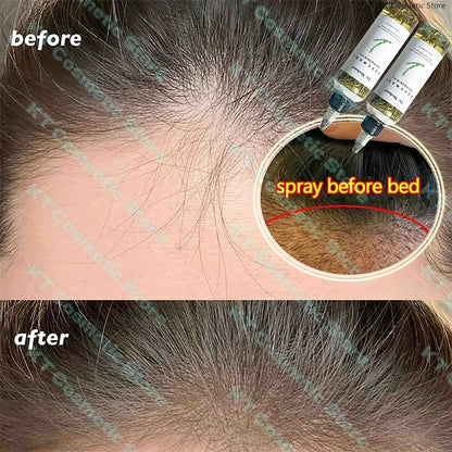 100ML Fast Hair Growth Oil Africa Crazy Traction Alopecia Serum Anti Hair Break Thicken Hair Loss Treatment Spray For Man Women